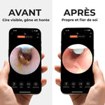 Charger l'image dans la galerie, EarVision™ | Nettoyeur auditif intelligent avec caméra HD pour une hygiène parfaite