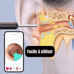 Charger l'image dans la galerie, EarVision™ | Nettoyeur auditif intelligent avec caméra HD pour une hygiène parfaite
